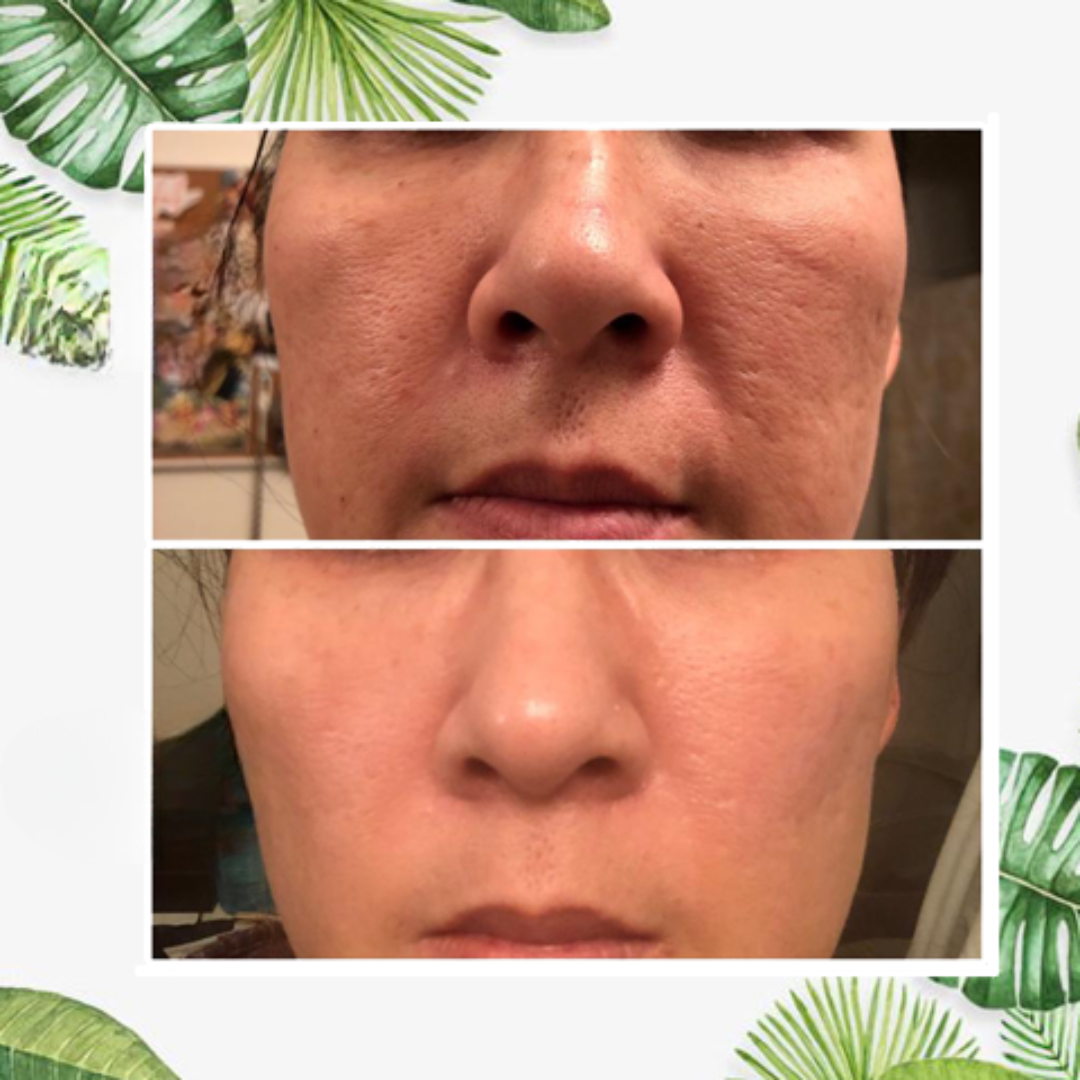 Face Mask Stick for Oily Skin Detox