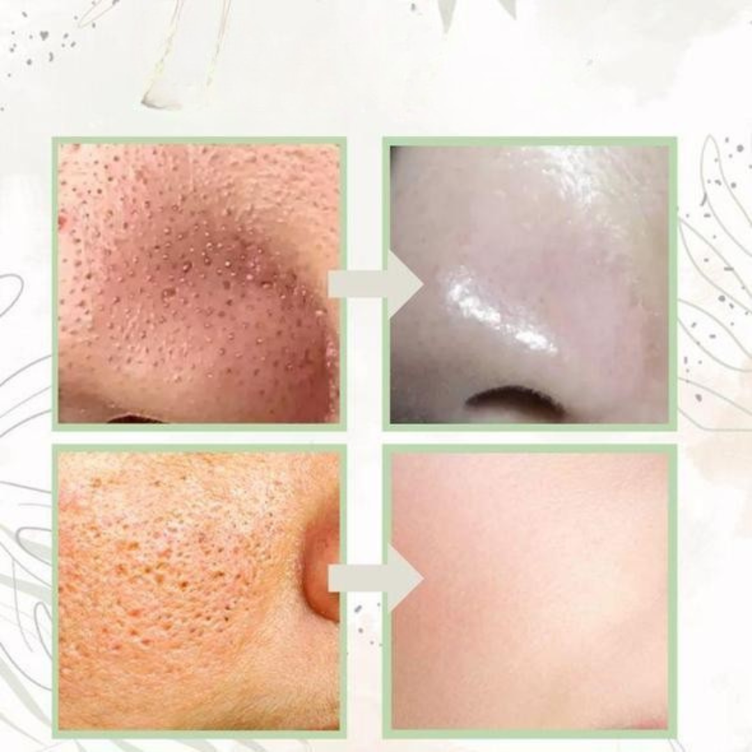 Face Mask Stick for Oily Skin Detox