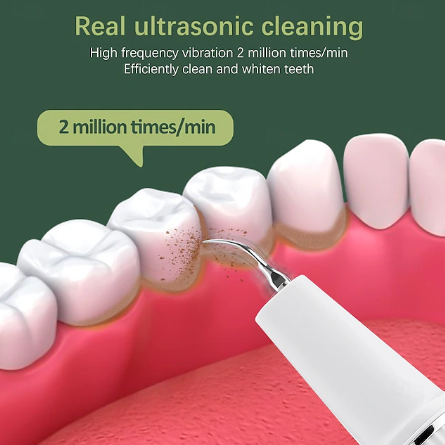 Dental Scaler | Ultrasonic Plaque Remover Tool for Home