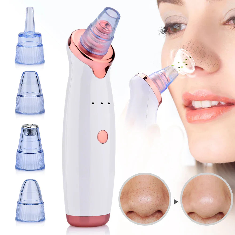Blackhead Remover Vacuum Pore Cleansing Device